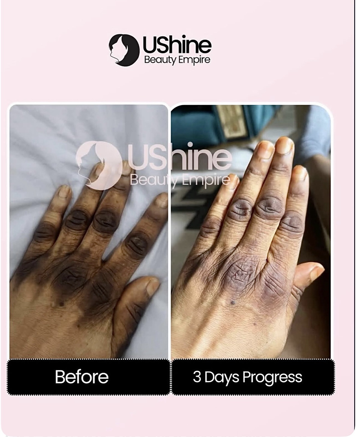 Knuckle Fade Cream - Image 4