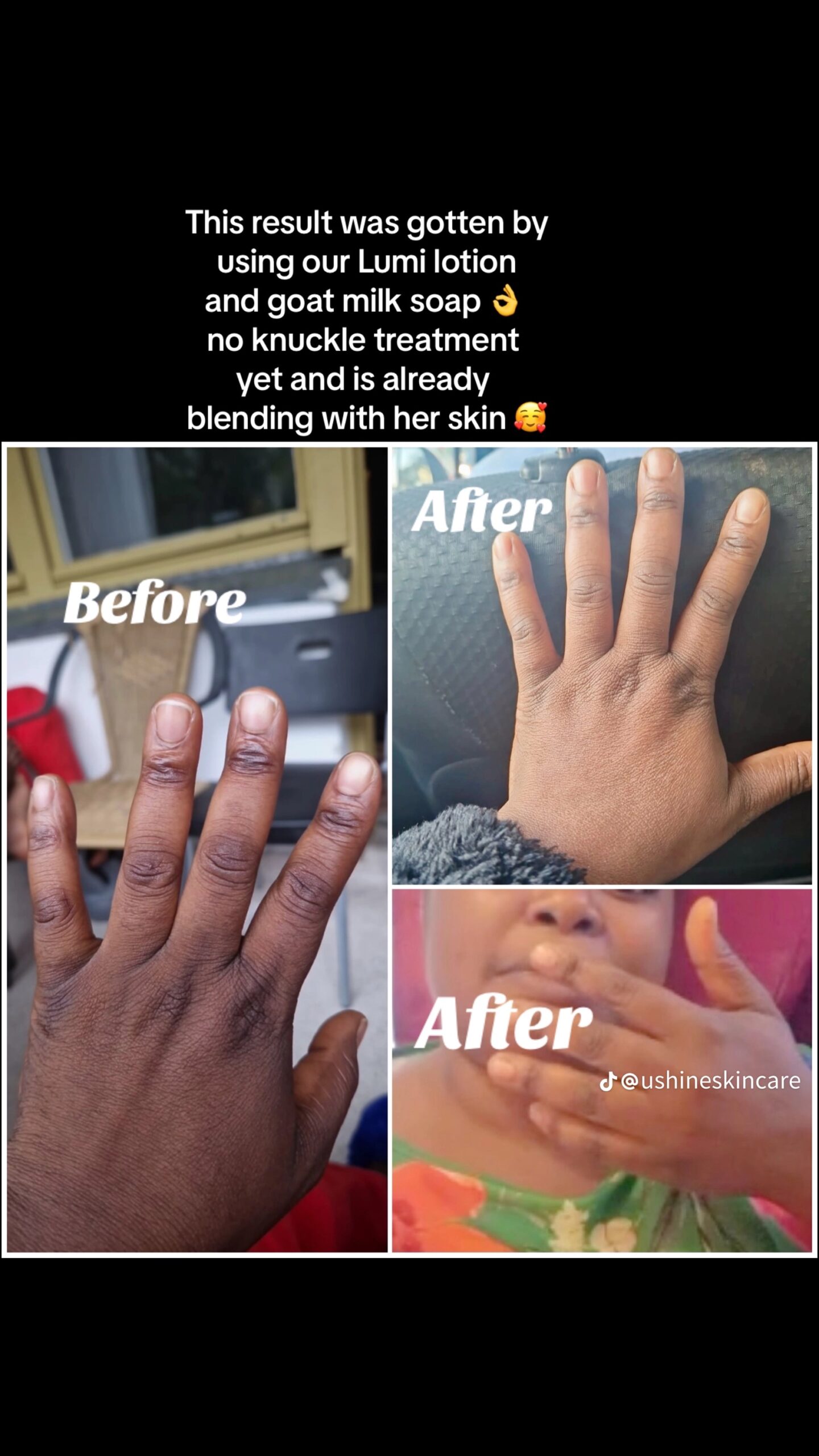 Knuckle Fade Cream - Image 2